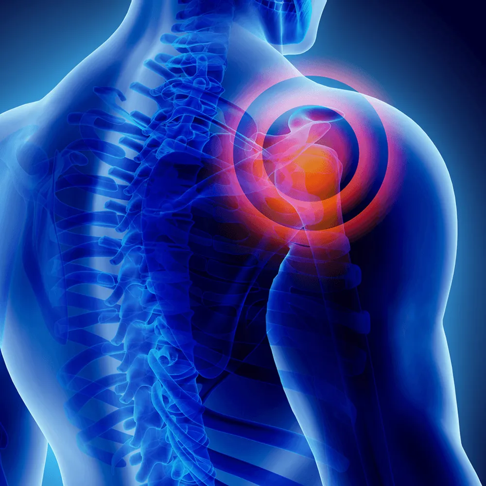 Interventional Pain Management