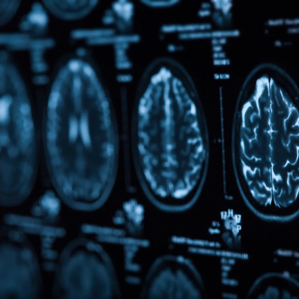 Neurology